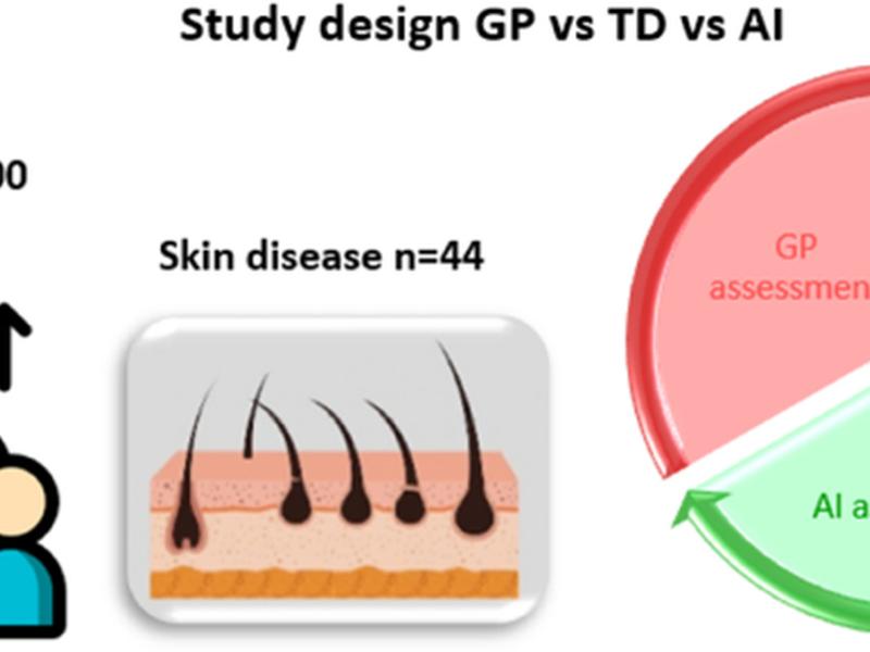 Exploring The Potential Of Artificial Intelligence In Improving Skin Lesion Diagnosis In Primary Care