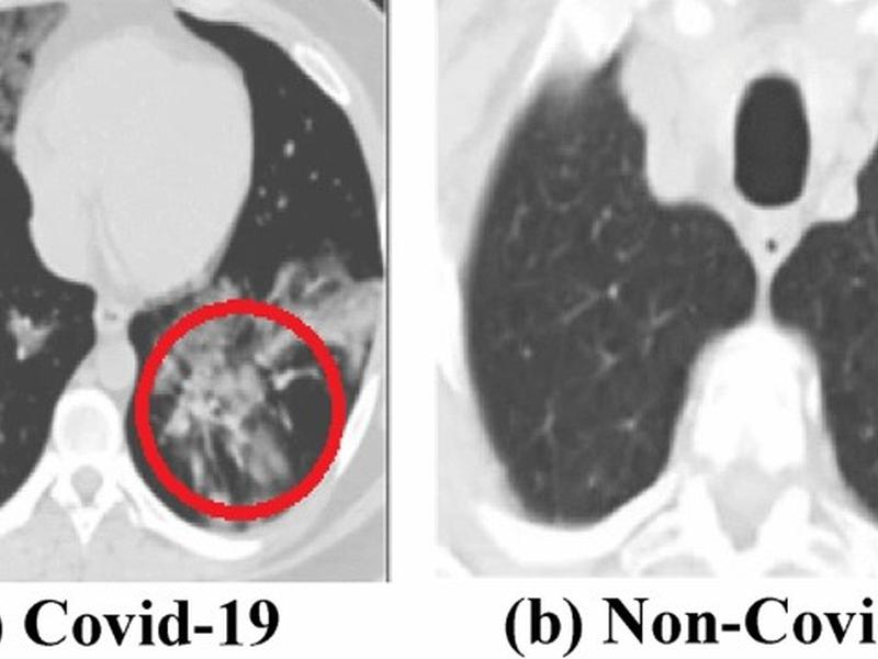 Learning Without Forgetting By Leveraging Transfer Learning For Detecting Covid-19 Infection From Ct Images