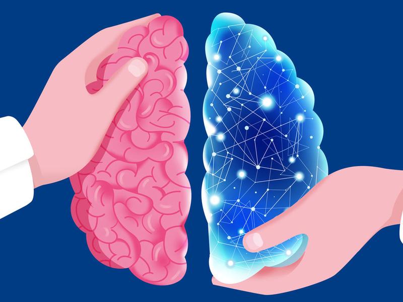 Artificial Brains Are Helping Scientists Study The Real Thing
