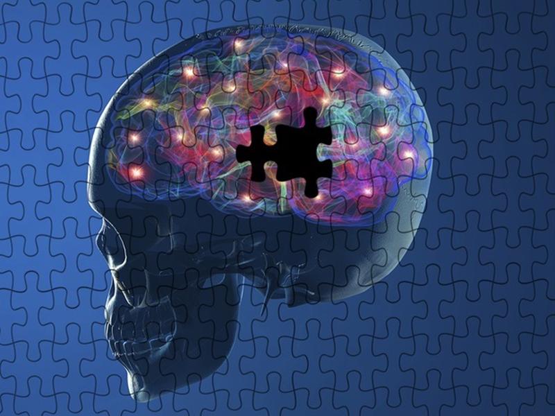 New Ai Tool Shows Early Promise In Detecting Parkinson’s Disease Years Before Symptom Onset
