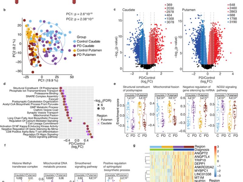 Blood Transcriptomic Signatures Associated With Molecular Changes In The Brain And Clinical Outcomes In Parkinson’s Disease