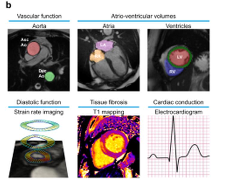 Environmental And Genetic Predictors Of Human Cardiovascular Ageing