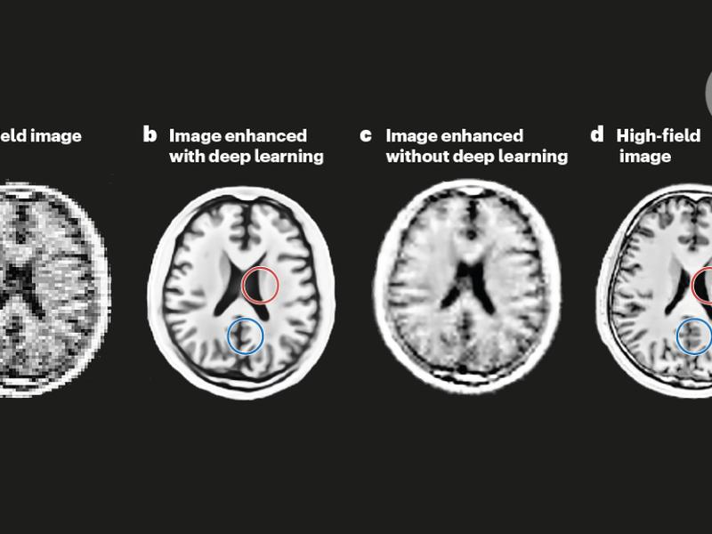 The Deep Route To Low-field Mri With High Potential