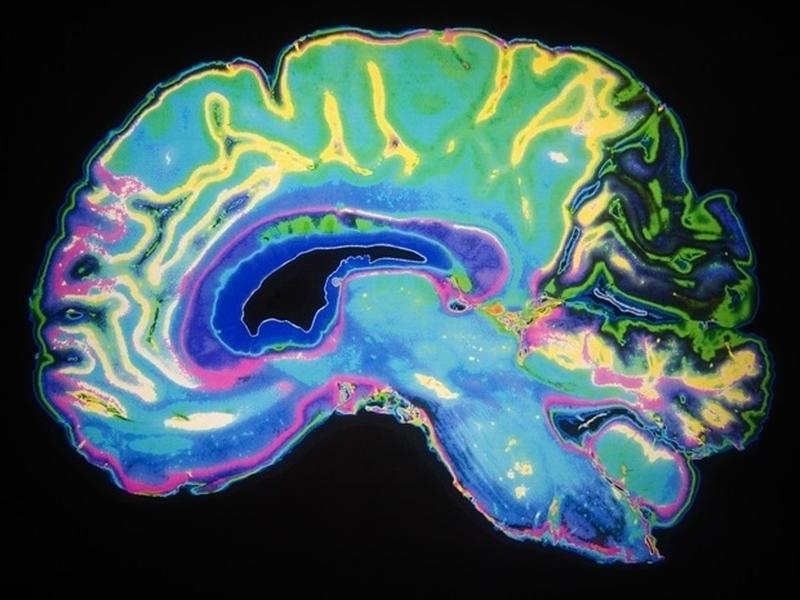 Deep Learning Models Replicate Human Auditory Processing