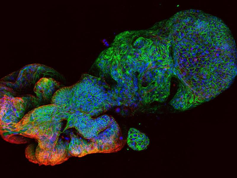 You Might Have Missed: Improving Bowel Cancer Treatment; Robot Inspectors; The First Continents; And Fledgling Planets