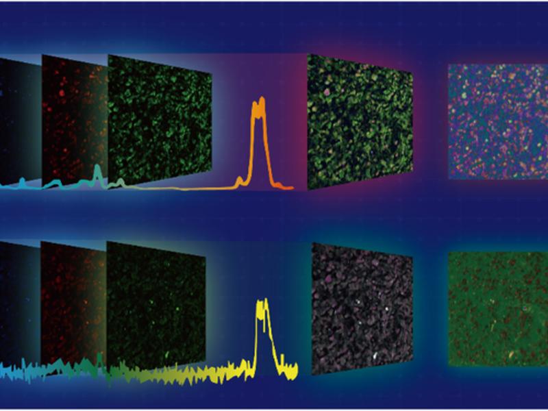 Rspssl: A Novel High-fidelity Raman Spectral Preprocessing Scheme To Enhance Biomedical Applications And Chemical Resolution Visualization