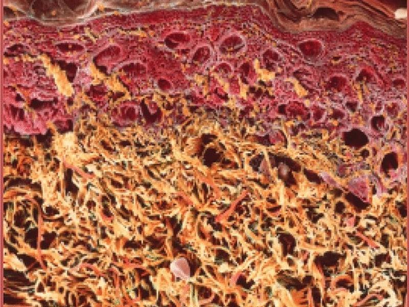 A Precise Model For Skin Cancer Diagnosis Using Hybrid U-net And Improved Mobilenet-v3 With Hyperparameters Optimization