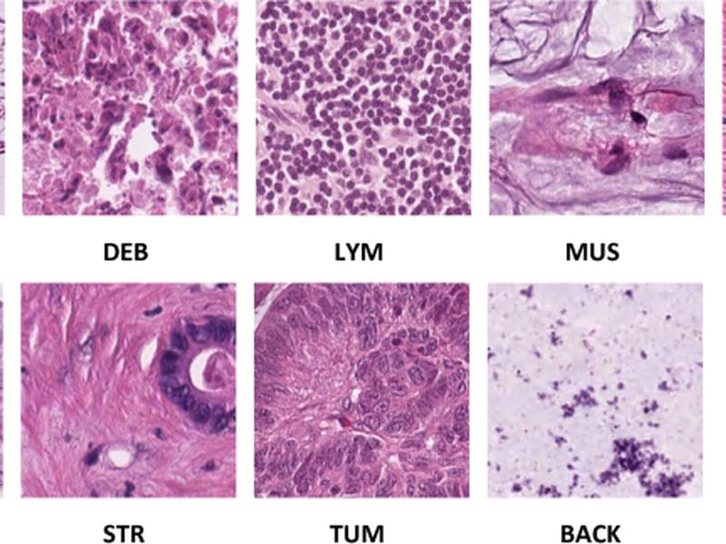 Color-cadx: A Deep Learning Approach For Colorectal Cancer Classification Through Triple Convolutional Neural Networks And Discrete Cosine Transform