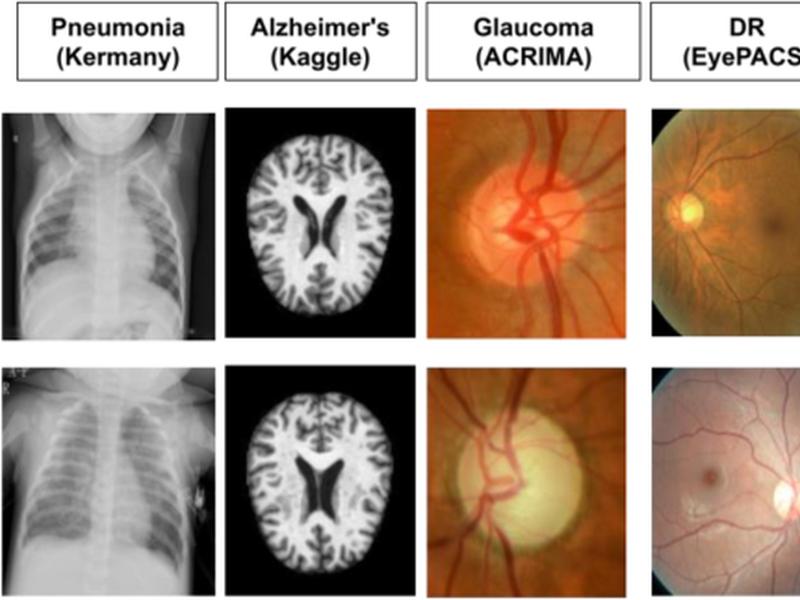A Comparative Study Of An On Premise Automl Solution For Medical Image Classification