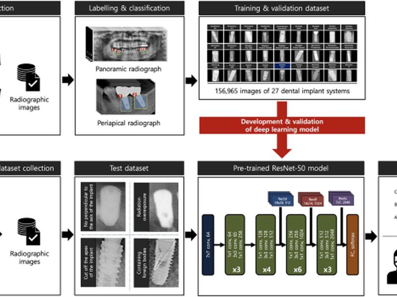 Identification Of Dental Implant Systems From Low-quality And Distorted Dental Radiographs Using Ai Trained On A Large Multi-center Dataset