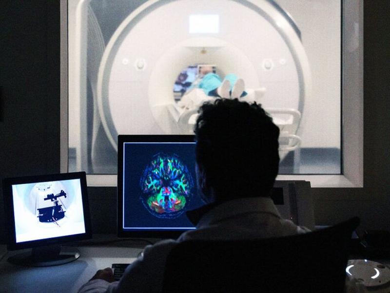 New Test May Predict Dementia Up To 9 Years Before Diagnosis With 80% Accuracy