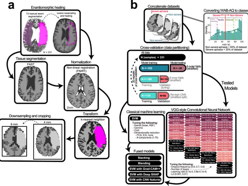 Distinct Brain Morphometry Patterns Revealed By Deep Learning Improve Prediction Of Post-stroke Aphasia Severity