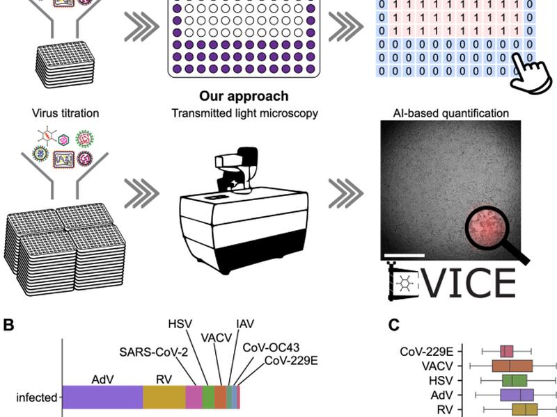 A Versatile Automated Pipeline For Quantifying Virus Infectivity By Label-free Light Microscopy And Artificial Intelligence