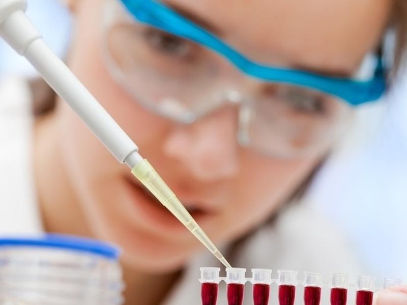 Ai-driven Blood Test Offers Hope For Early Parkinson’s Diagnosis