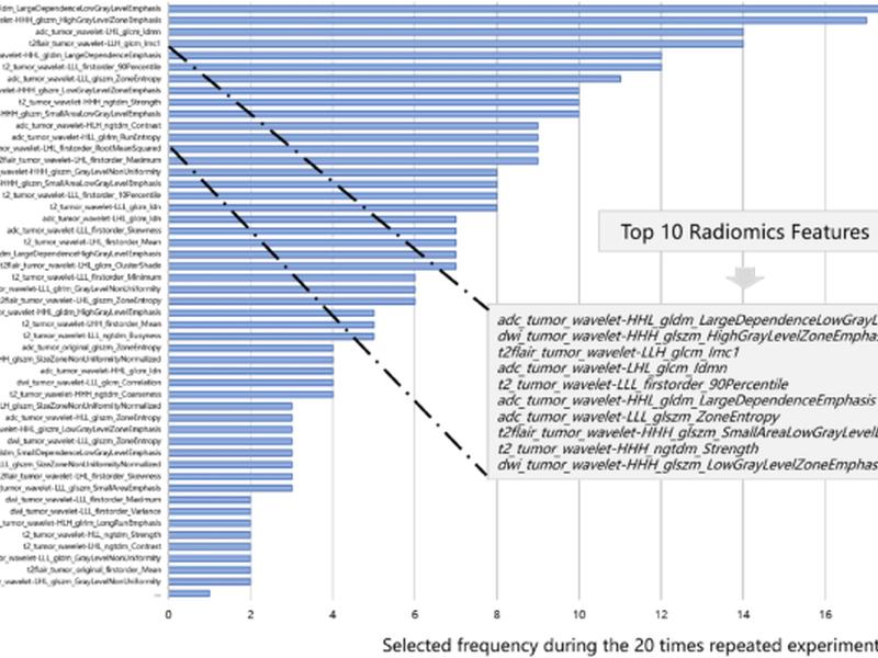 Predicting Histological Grade In Pediatric Glioma Using Multiparametric Radiomics And Conventional Mri Features