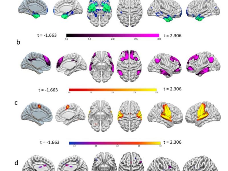 Decoding Acceptance And Reappraisal Strategies From Resting State Macro Networks