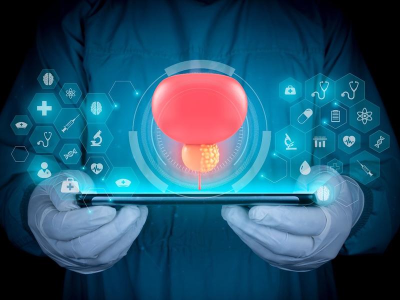 Deep Learning Model Rivals Radiologists In Detecting Prostate Cancer With Mri